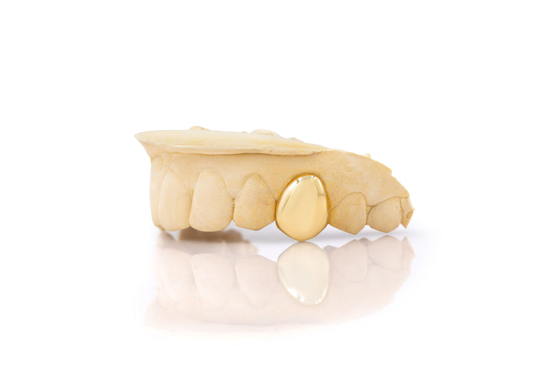 Classic Solid Gold Grillz