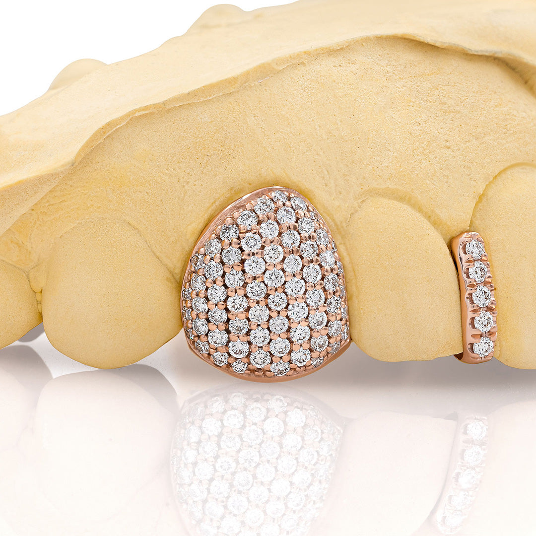 rose_gold_diamond_grillz_rose_gold_grillz_diamonds_one_tooth_grillz_diamond_diamond_vampire_grillz_vvs_diamond_grillz_price_iced_out_diamond_grillz_in_mouth_diamond_cut_grillz_in_mouth_diamond_cut_rose_gold_grillz_teeth_grillz_diamond_diamond_grillz_nearby_vs_diamond_grillz_iced_out_diamond_grillz_diamond_iced_out_grillz_grills_teeth_custom_grills_teeth_real_grills_teeth_diamond_rose_gold_grills_custom_grills_near_me_iced_out_grills_rapper_grills