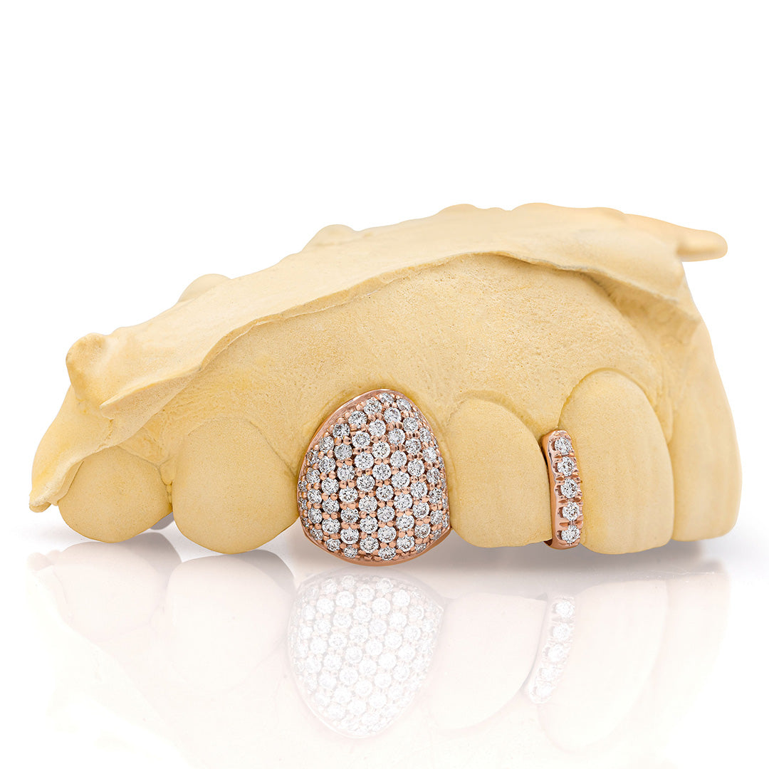 rose_gold_diamond_grillz_rose_gold_grillz_diamonds_one_tooth_grillz_diamond_diamond_vampire_grillz_vvs_diamond_grillz_price_iced_out_diamond_grillz_in_mouth_diamond_cut_grillz_in_mouth_diamond_cut_rose_gold_grillz_teeth_grillz_diamond_diamond_grillz_nearby_vs_diamond_grillz_iced_out_diamond_grillz_diamond_iced_out_grillz_grills_teeth_custom_grills_teeth_real_grills_teeth_diamond_rose_gold_grills_custom_grills_near_me_iced_out_grills_rapper_grills