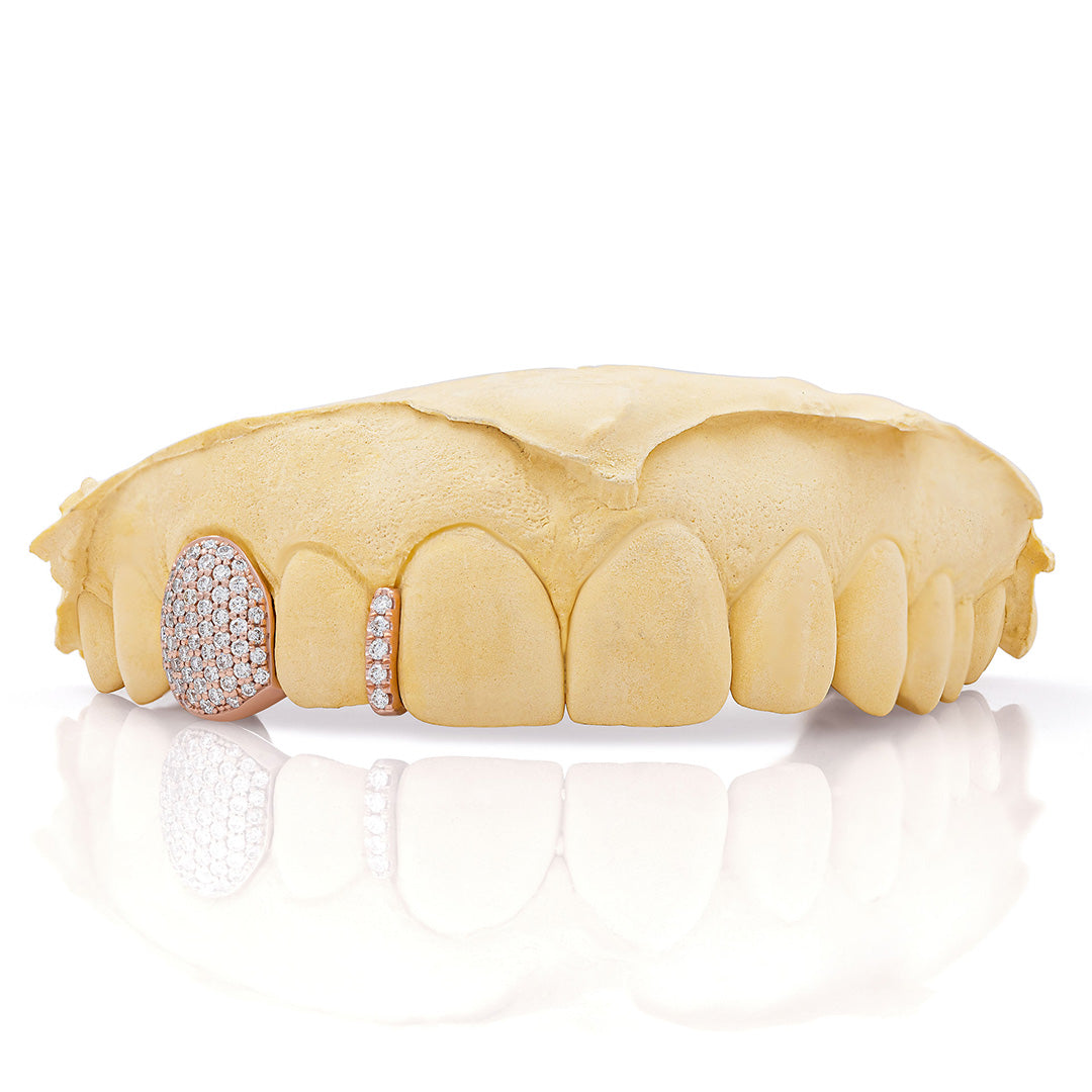 rose_gold_diamond_grillz_rose_gold_grillz_diamonds_one_tooth_grillz_diamond_diamond_vampire_grillz_vvs_diamond_grillz_price_iced_out_diamond_grillz_in_mouth_diamond_cut_grillz_in_mouth_diamond_cut_rose_gold_grillz_teeth_grillz_diamond_diamond_grillz_nearby_vs_diamond_grillz_iced_out_diamond_grillz_diamond_iced_out_grillz_grills_teeth_custom_grills_teeth_real_grills_teeth_diamond_rose_gold_grills_custom_grills_near_me_iced_out_grills_rapper_grills