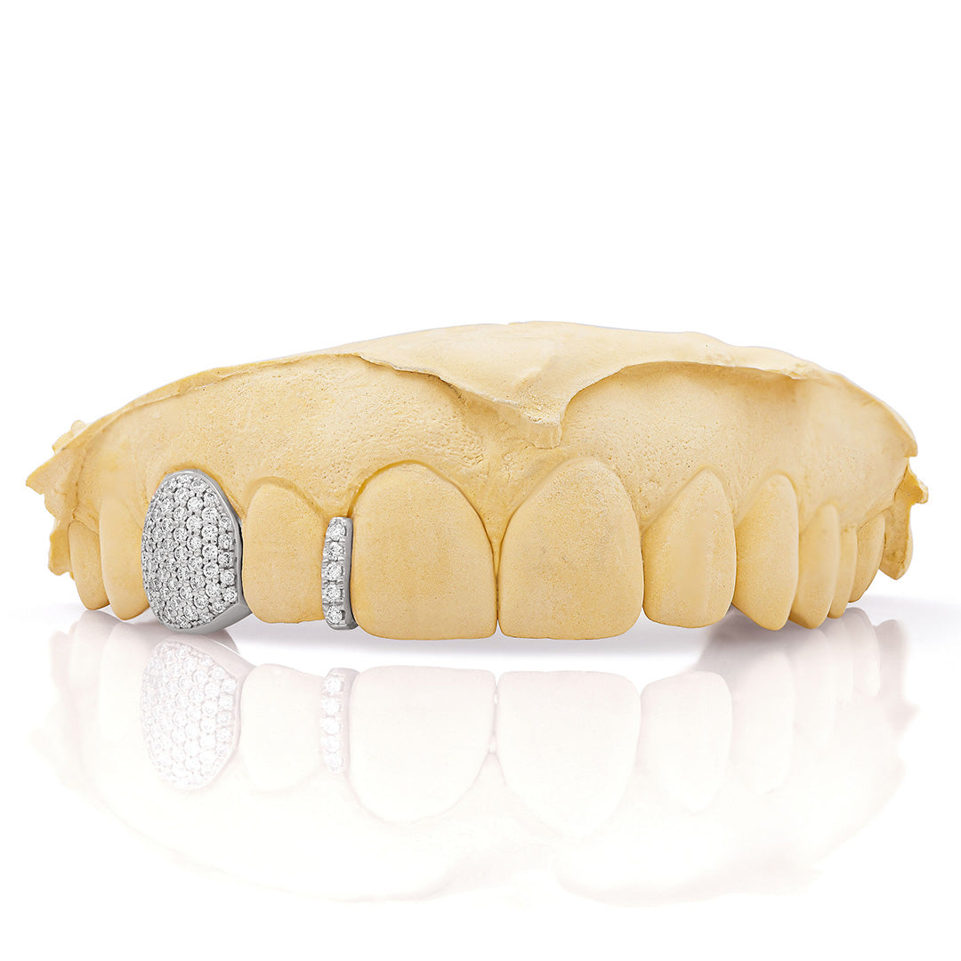 white_gold_diamond_grillz_white_gold_grillz_diamonds_one_tooth_grillz_diamond_diamond_vampire_grillz_vvs_diamond_grillz_price_iced_out_diamond_grillz_in_mouth_diamond_cut_grillz_in_mouth_diamond_cut_white_gold_grillz_teeth_grillz_diamond_diamond_grillz_nearby_vs_diamond_grillz_iced_out_diamond_grillz_diamond_iced_out_grillz_grills_teeth_custom_grills_teeth_real_grills_teeth_diamond_white_gold_grills_custom_grills_near_me_iced_out_grills_rapper_grills