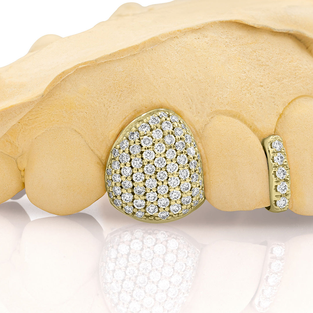 yellow_gold_diamond_grillz_yellow_gold_grillz_diamonds_one_tooth_grillz_diamond_diamond_vampire_grillz_vvs_diamond_grillz_price_iced_out_diamond_grillz_in_mouth_diamond_cut_grillz_in_mouth_diamond_cut_yellow_gold_grillz_teeth_grillz_diamond_diamond_grillz_nearby_vs_diamond_grillz_iced_out_diamond_grillz_diamond_iced_out_grillz_grills_teeth_custom_grills_teeth_real_grills_teeth_diamond_yellow_gold_grills_custom_grills_near_me_iced_out_grills_rapper_grills