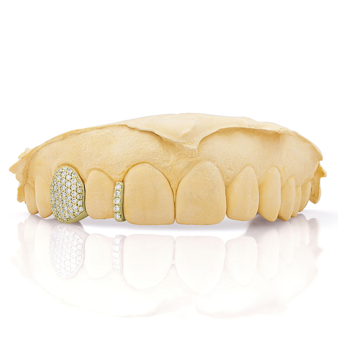yellow_gold_diamond_grillz_yellow_gold_grillz_diamonds_one_tooth_grillz_diamond_diamond_vampire_grillz_vvs_diamond_grillz_price_iced_out_diamond_grillz_in_mouth_diamond_cut_grillz_in_mouth_diamond_cut_yellow_gold_grillz_teeth_grillz_diamond_diamond_grillz_nearby_vs_diamond_grillz_iced_out_diamond_grillz_diamond_iced_out_grillz_grills_teeth_custom_grills_teeth_real_grills_teeth_diamond_yellow_gold_grills_custom_grills_near_me_iced_out_grills_rapper_grills
