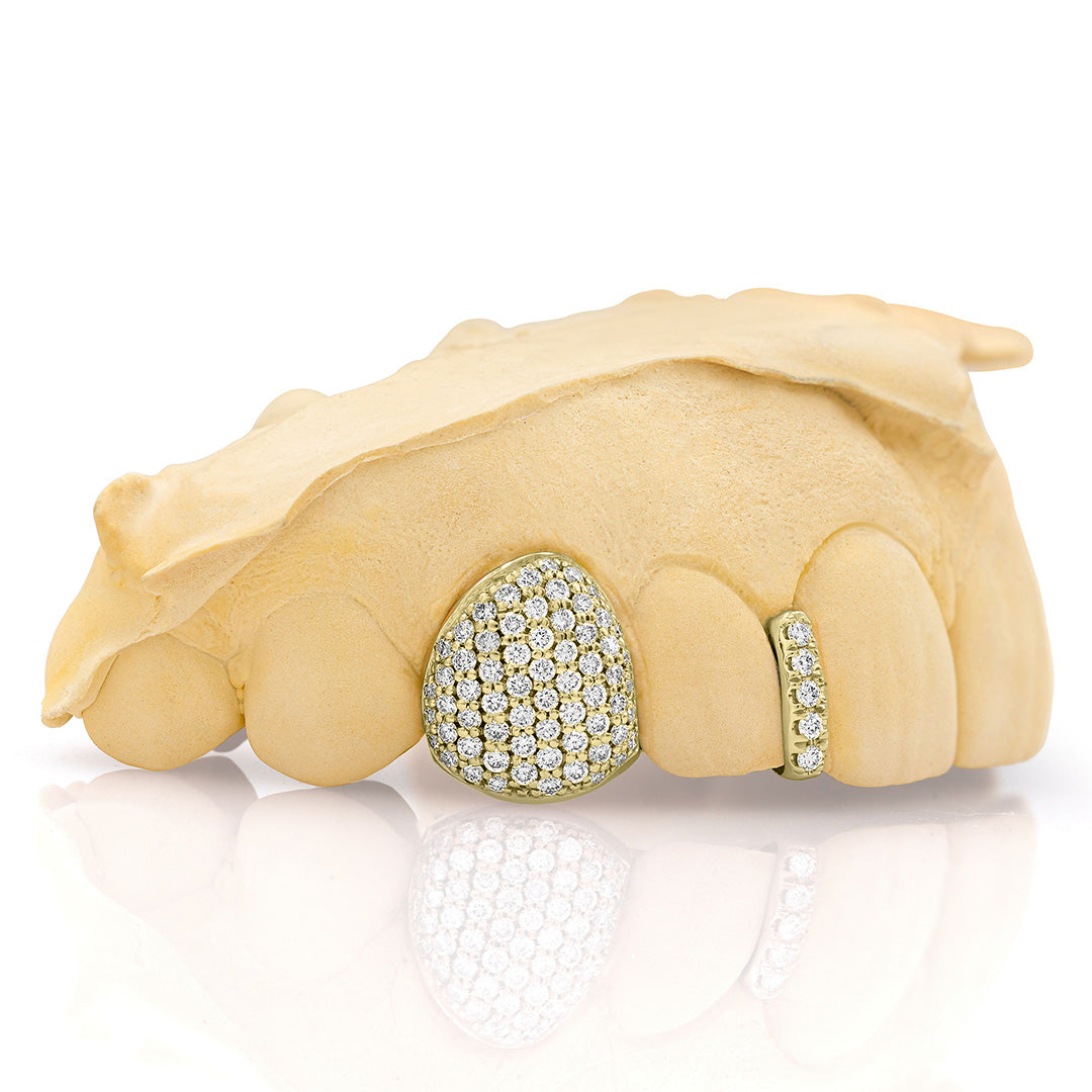 yellow_gold_diamond_grillz_yellow_gold_grillz_diamonds_one_tooth_grillz_diamond_diamond_vampire_grillz_vvs_diamond_grillz_price_iced_out_diamond_grillz_in_mouth_diamond_cut_grillz_in_mouth_diamond_cut_yellow_gold_grillz_teeth_grillz_diamond_diamond_grillz_nearby_vs_diamond_grillz_iced_out_diamond_grillz_diamond_iced_out_grillz_grills_teeth_custom_grills_teeth_real_grills_teeth_diamond_yellow_gold_grills_custom_grills_near_me_iced_out_grills_rapper_grills
