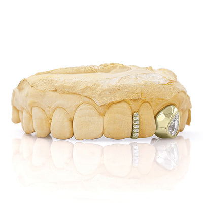 yellow_gold_and_diamond_grillz_grillz_jewelry_for_sale_gold_grillz_designs_yellow_gold_grillz_diamond_cut_14kt_gold_grillz_grillz_teeth_designs_teeth_grillz_price_grillz_diamond_grillz_custom_grillz_top_teeth_grillz_shop_gold_grillz_online_grillz_real_custom_made_grillz_top_gold_grillz_grillz_removable_celebrities_with_grillz_yellow_gold_grillz_in_mouth_grills_mouth_near_me_teeth_grills_near_me_custom_gold_grills_customize_grills_grills_for_teeth_custom_grills_for_the_mouth
