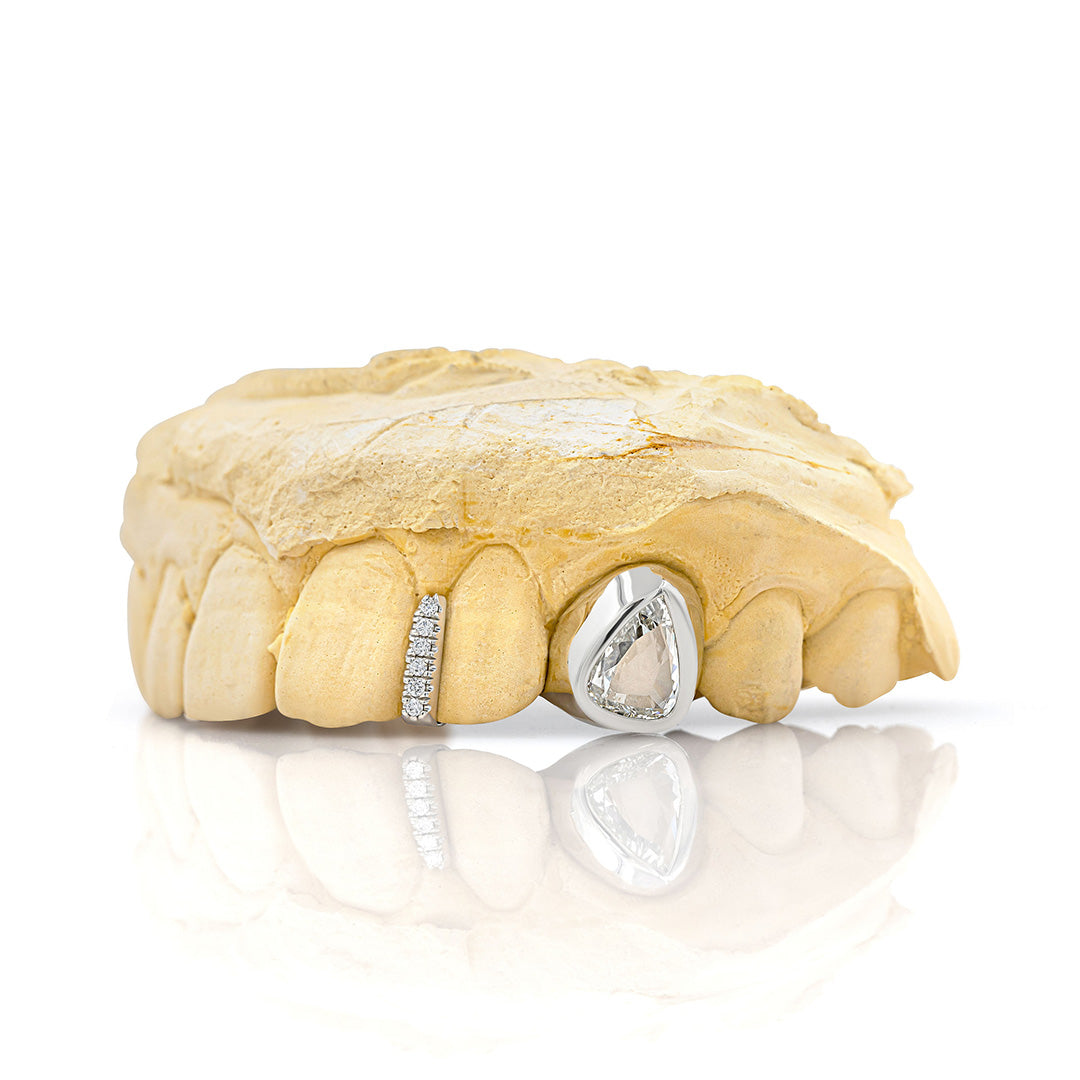 white_gold_and_diamond_grillz_grillz_jewelry_for_sale_gold_grillz_designs_white_gold_grillz_diamond_cut_14kt_gold_grillz_grillz_teeth_designs_teeth_grillz_price_grillz_diamond_grillz_custom_grillz_top_teeth_grillz_shop_gold_grillz_online_grillz_real_custom_made_grillz_top_gold_grillz_grillz_removable_celebrities_with_grillz_white_gold_grillz_in_mouth_grills_mouth_near_me_teeth_grills_near_me_custom_gold_grills_customize_grills_grills_for_teeth_custom_grills_for_the_mouth