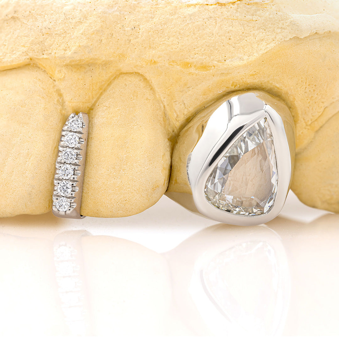 white_gold_and_diamond_grillz_grillz_jewelry_for_sale_gold_grillz_designs_white_gold_grillz_diamond_cut_14kt_gold_grillz_grillz_teeth_designs_teeth_grillz_price_grillz_diamond_grillz_custom_grillz_top_teeth_grillz_shop_gold_grillz_online_grillz_real_custom_made_grillz_top_gold_grillz_grillz_removable_celebrities_with_grillz_white_gold_grillz_in_mouth_grills_mouth_near_me_teeth_grills_near_me_custom_gold_grills_customize_grills_grills_for_teeth_custom_grills_for_the_mouth