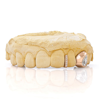 rose_gold_and_diamond_grillz_grillz_jewelry_for_sale_gold_grillz_designs_rose_gold_grillz_diamond_cut_14kt_gold_grillz_grillz_teeth_designs_teeth_grillz_price_grillz_diamond_grillz_custom_grillz_top_teeth_grillz_shop_gold_grillz_online_grillz_real_custom_made_grillz_top_gold_grillz_grillz_removable_celebrities_with_grillz_rose_gold_grillz_in_mouth_grills_mouth_near_me_teeth_grills_near_me_custom_gold_grills_customize_grills_grills_for_teeth_custom_grills_for_the_mouth