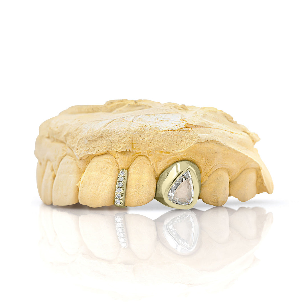 yellow_gold_and_diamond_grillz_grillz_jewelry_for_sale_gold_grillz_designs_yellow_gold_grillz_diamond_cut_14kt_gold_grillz_grillz_teeth_designs_teeth_grillz_price_grillz_diamond_grillz_custom_grillz_top_teeth_grillz_shop_gold_grillz_online_grillz_real_custom_made_grillz_top_gold_grillz_grillz_removable_celebrities_with_grillz_yellow_gold_grillz_in_mouth_grills_mouth_near_me_teeth_grills_near_me_custom_gold_grills_customize_grills_grills_for_teeth_custom_grills_for_the_mouth