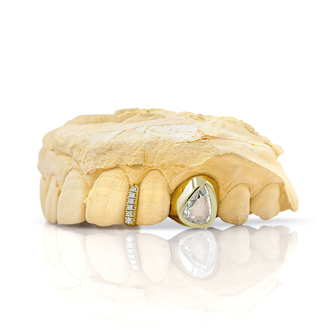 yellow_gold_and_diamond_grillz_grillz_jewelry_for_sale_gold_grillz_designs_yellow_gold_grillz_diamond_cut_14kt_gold_grillz_grillz_teeth_designs_teeth_grillz_price_grillz_diamond_grillz_custom_grillz_top_teeth_grillz_shop_gold_grillz_online_grillz_real_custom_made_grillz_top_gold_grillz_grillz_removable_celebrities_with_grillz_yellow_gold_grillz_in_mouth_grills_mouth_near_me_teeth_grills_near_me_custom_gold_grills_customize_grills_grills_for_teeth_custom_grills_for_the_mouth