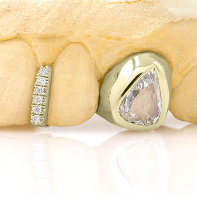 yellow_gold_and_diamond_grillz_grillz_jewelry_for_sale_gold_grillz_designs_yellow_gold_grillz_diamond_cut_14kt_gold_grillz_grillz_teeth_designs_teeth_grillz_price_grillz_diamond_grillz_custom_grillz_top_teeth_grillz_shop_gold_grillz_online_grillz_real_custom_made_grillz_top_gold_grillz_grillz_removable_celebrities_with_grillz_yellow_gold_grillz_in_mouth_grills_mouth_near_me_teeth_grills_near_me_custom_gold_grills_customize_grills_grills_for_teeth_custom_grills_for_the_mouth