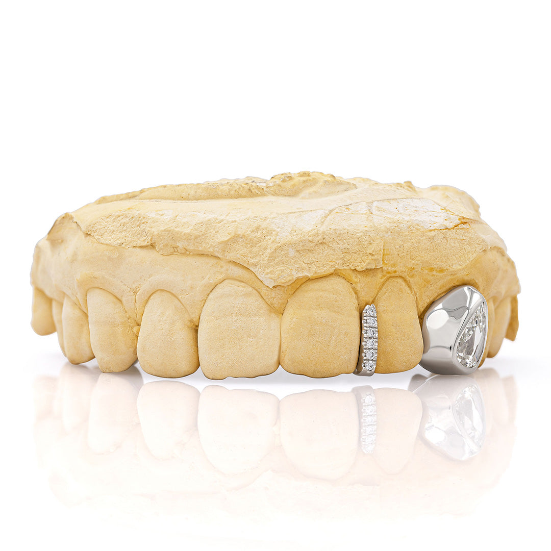white_gold_and_diamond_grillz_grillz_jewelry_for_sale_gold_grillz_designs_white_gold_grillz_diamond_cut_14kt_gold_grillz_grillz_teeth_designs_teeth_grillz_price_grillz_diamond_grillz_custom_grillz_top_teeth_grillz_shop_gold_grillz_online_grillz_real_custom_made_grillz_top_gold_grillz_grillz_removable_celebrities_with_grillz_white_gold_grillz_in_mouth_grills_mouth_near_me_teeth_grills_near_me_custom_gold_grills_customize_grills_grills_for_teeth_custom_grills_for_the_mouth