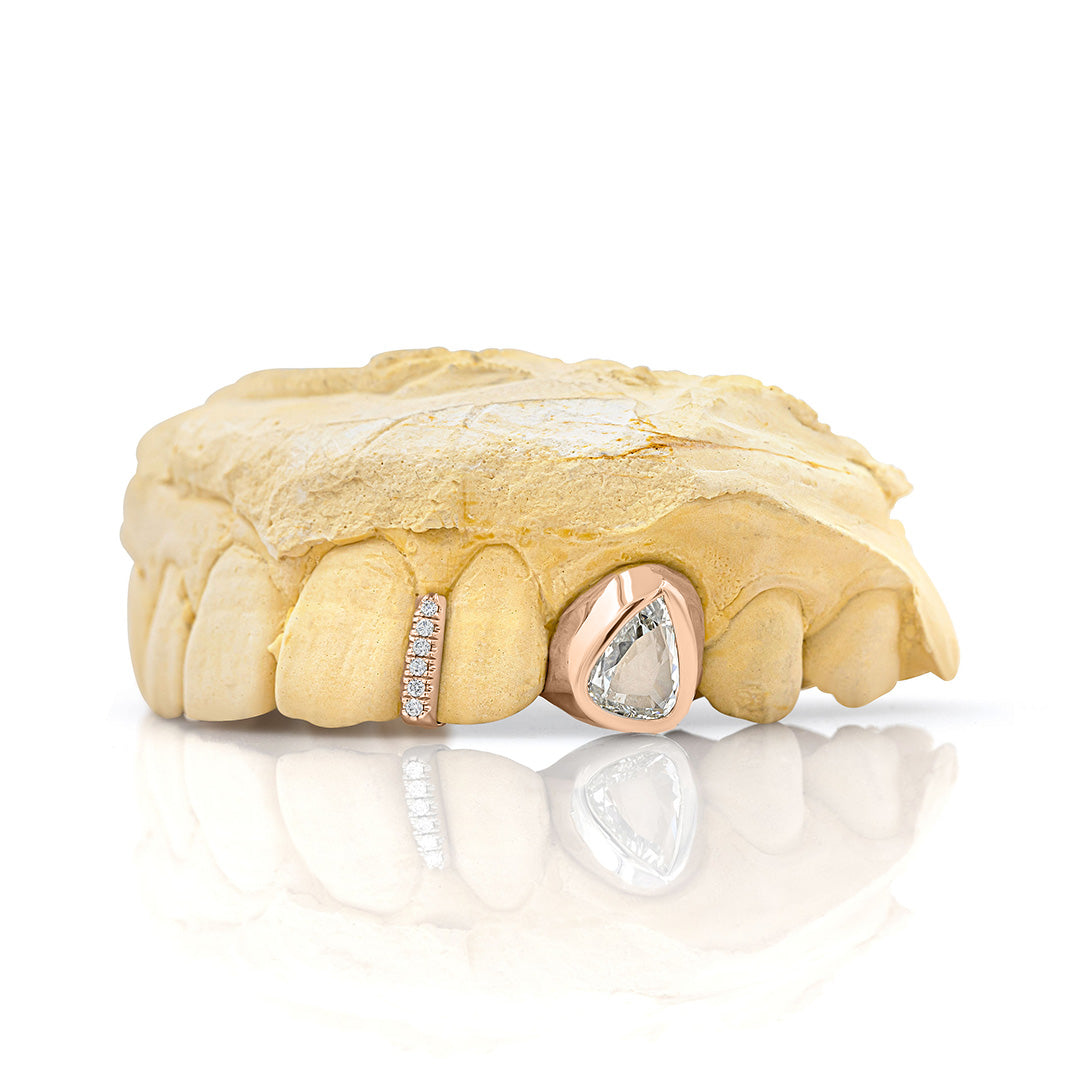 rose_gold_and_diamond_grillz_grillz_jewelry_for_sale_gold_grillz_designs_rose_gold_grillz_diamond_cut_14kt_gold_grillz_grillz_teeth_designs_teeth_grillz_price_grillz_diamond_grillz_custom_grillz_top_teeth_grillz_shop_gold_grillz_online_grillz_real_custom_made_grillz_top_gold_grillz_grillz_removable_celebrities_with_grillz_rose_gold_grillz_in_mouth_grills_mouth_near_me_teeth_grills_near_me_custom_gold_grills_customize_grills_grills_for_teeth_custom_grills_for_the_mouth