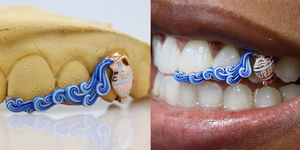 custom_teeth_grillz_design_grillz_enamel_grillz_gold_mouth_grillz_grillz_for_teeth_for_sale_gold_grillz_cost_grillz_teeth_gold_most_expensive_grillz_molded_grillz_gold_grillz_designs_gold_grillz_with_gap_teeth_women's_gold_grillz_women_grillz_female_gold_grillz_18_karat_gold_grillz_grillz_teeth_designs_grillz_mouthpiece_grillz_gold_grillz_online_grillz_real_custom_made_grillz_fronts_grillz_grillz_removable_grillz_gap_filler_grillz_with_mold_grillz_gap_teeth_pics_of_teeth_grillz_teeth_grillz_pics