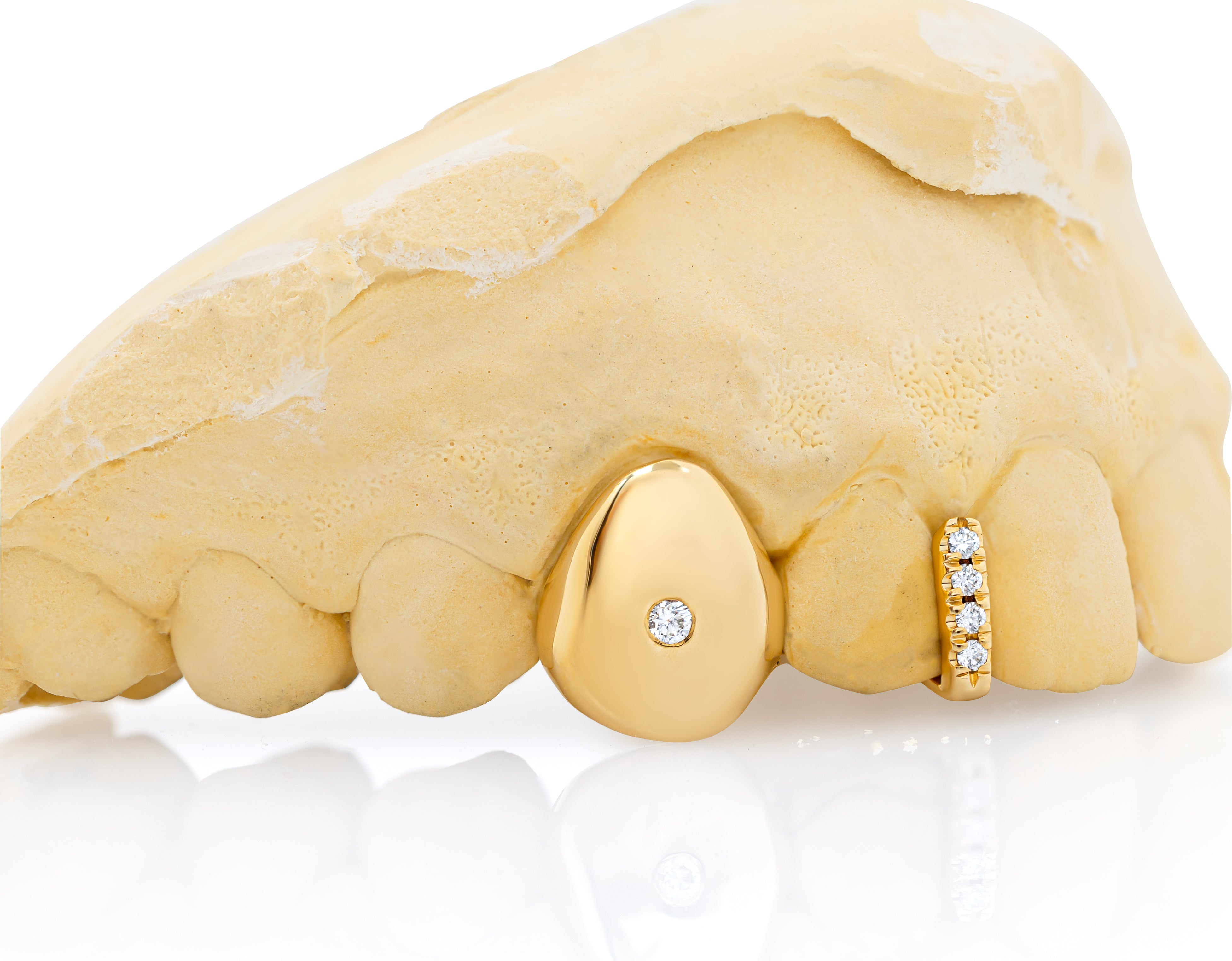 gold_and_diamond_teeth_grillz_gold_diamond_teeth_grillz_diamond_cut_grillz_gold_gold_diamond_grillz_teeth_white_gold_grillz_with_diamonds_grills_teeth_custom_gold_grills_customize_grills_grills_for_teeth_custom_grills_for_the_mouth_grills_mouth_near_me_teeth_grills_near_me_gold_grills_near_me_golden_grills_grills_for_mouth_grills_for_your_teeth_grills_for_teeth_mouth_grills_custom_grills_grills_teeth_teeth_grills