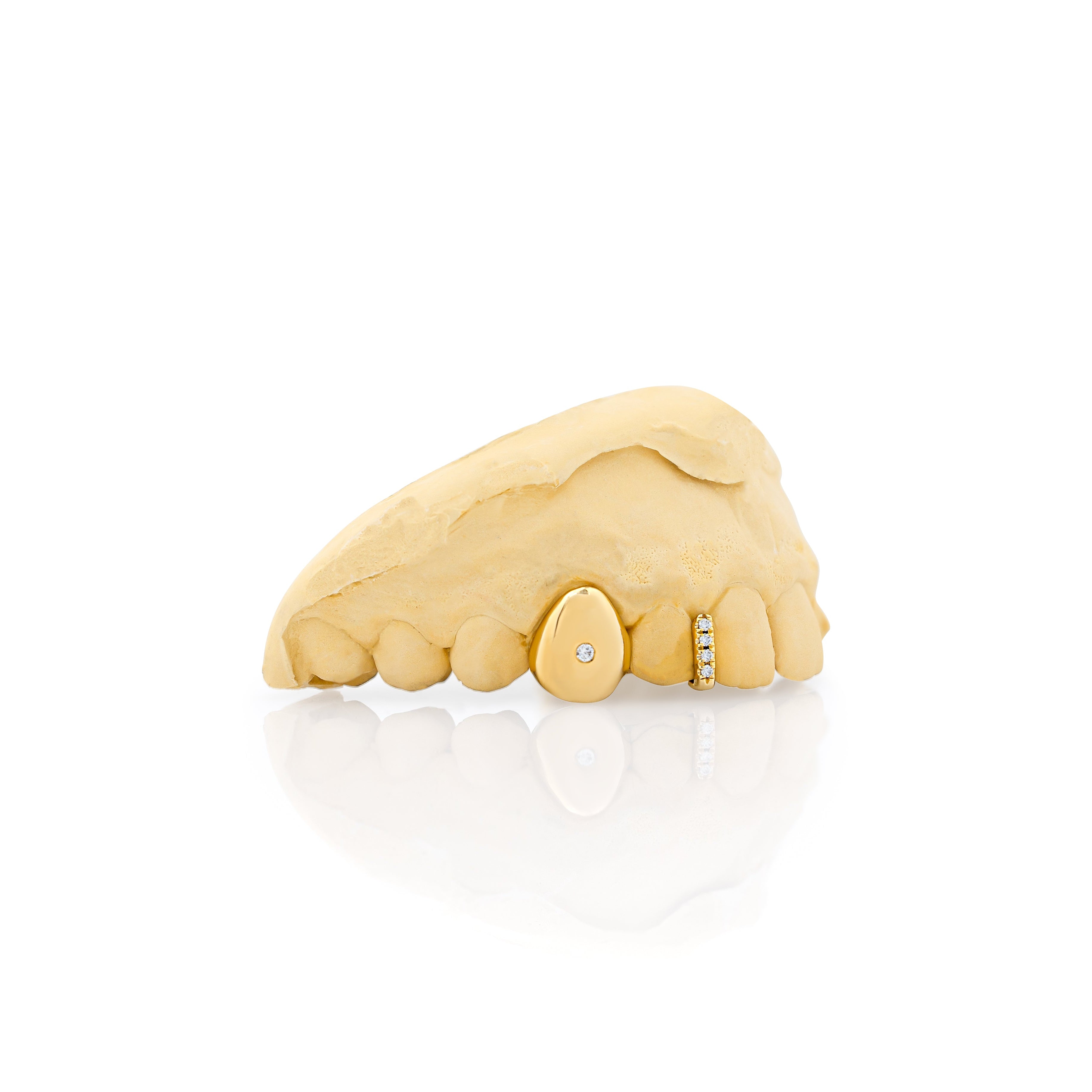 gold_and_diamond_teeth_grillz_gold_diamond_teeth_grillz_diamond_cut_grillz_gold_gold_diamond_grillz_teeth_white_gold_grillz_with_diamonds_grills_teeth_custom_gold_grills_customize_grills_grills_for_teeth_custom_grills_for_the_mouth_grills_mouth_near_me_teeth_grills_near_me_gold_grills_near_me_golden_grills_grills_for_mouth_grills_for_your_teeth_grills_for_teeth_mouth_grills_custom_grills_grills_teeth_teeth_grills