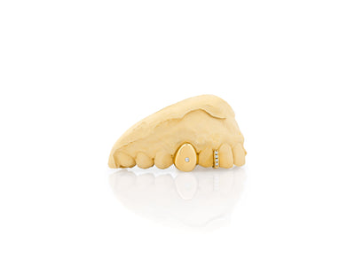 gold_and_diamond_teeth_grillz_gold_diamond_teeth_grillz_diamond_cut_grillz_gold_gold_diamond_grillz_teeth_white_gold_grillz_with_diamonds_grills_teeth_custom_gold_grills_customize_grills_grills_for_teeth_custom_grills_for_the_mouth_grills_mouth_near_me_teeth_grills_near_me_gold_grills_near_me_golden_grills_grills_for_mouth_grills_for_your_teeth_grills_for_teeth_mouth_grills_custom_grills_grills_teeth_teeth_grills
