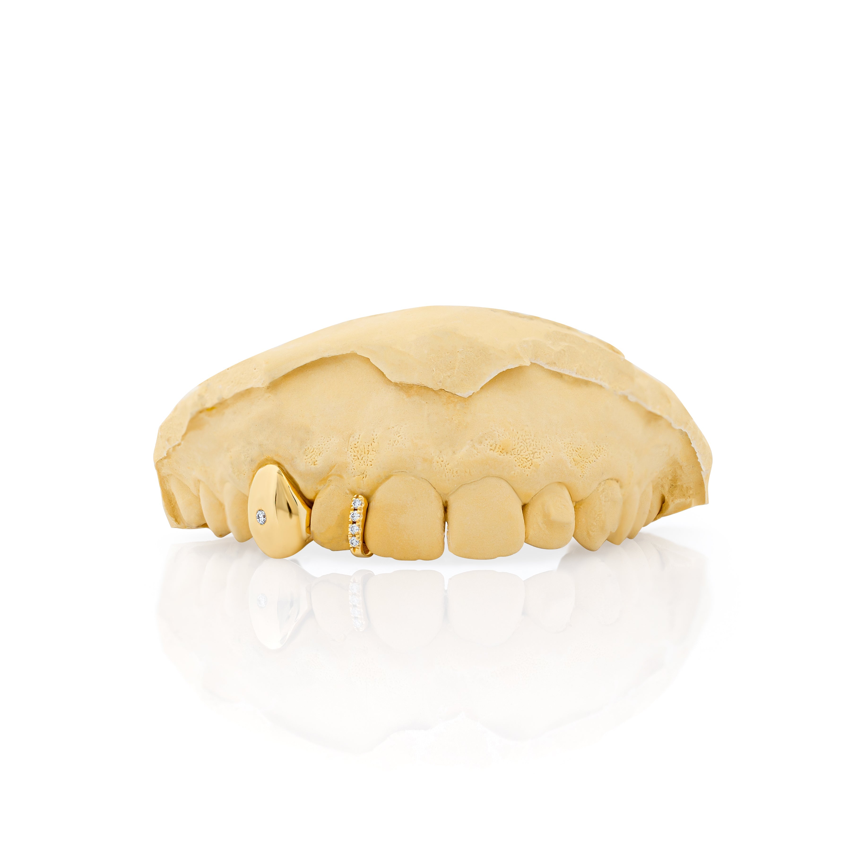 gold_and_diamond_teeth_grillz_gold_diamond_teeth_grillz_diamond_cut_grillz_gold_gold_diamond_grillz_teeth_white_gold_grillz_with_diamonds_grills_teeth_custom_gold_grills_customize_grills_grills_for_teeth_custom_grills_for_the_mouth_grills_mouth_near_me_teeth_grills_near_me_gold_grills_near_me_golden_grills_grills_for_mouth_grills_for_your_teeth_grills_for_teeth_mouth_grills_custom_grills_grills_teeth_teeth_grills
