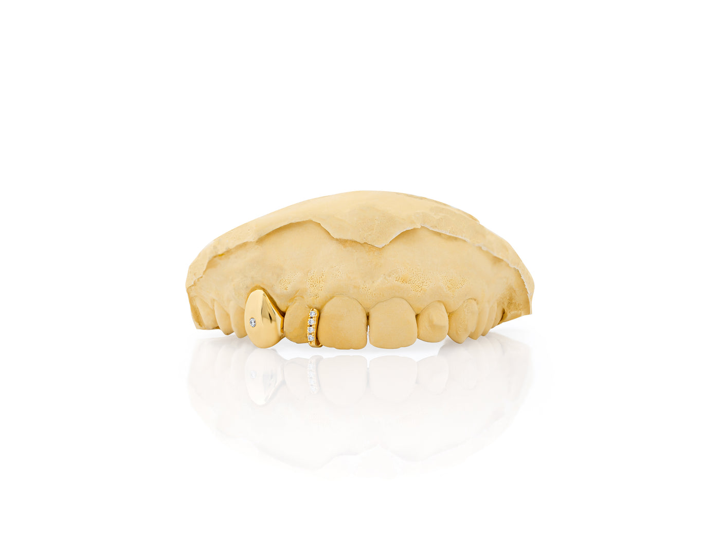 gold_and_diamond_teeth_grillz_gold_diamond_teeth_grillz_diamond_cut_grillz_gold_gold_diamond_grillz_teeth_white_gold_grillz_with_diamonds_grills_teeth_custom_gold_grills_customize_grills_grills_for_teeth_custom_grills_for_the_mouth_grills_mouth_near_me_teeth_grills_near_me_gold_grills_near_me_golden_grills_grills_for_mouth_grills_for_your_teeth_grills_for_teeth_mouth_grills_custom_grills_grills_teeth_teeth_grills