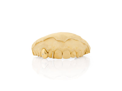gold_and_diamond_teeth_grillz_gold_diamond_teeth_grillz_diamond_cut_grillz_gold_gold_diamond_grillz_teeth_white_gold_grillz_with_diamonds_grills_teeth_custom_gold_grills_customize_grills_grills_for_teeth_custom_grills_for_the_mouth_grills_mouth_near_me_teeth_grills_near_me_gold_grills_near_me_golden_grills_grills_for_mouth_grills_for_your_teeth_grills_for_teeth_mouth_grills_custom_grills_grills_teeth_teeth_grills
