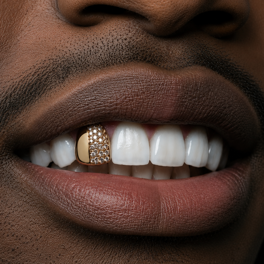 Custom gold grill with pavé diamond detail, close-up
