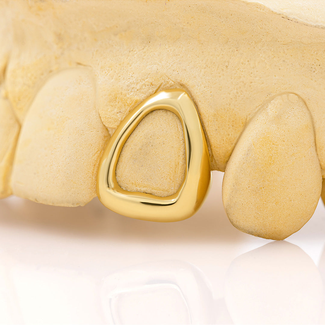 Gold Frame Grillz