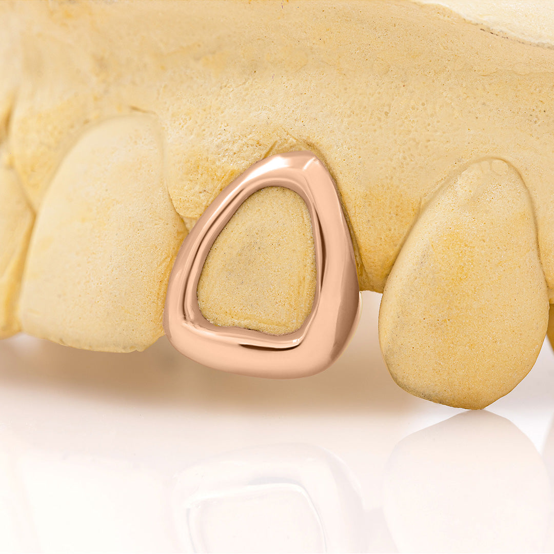 Gold Frame Grillz
