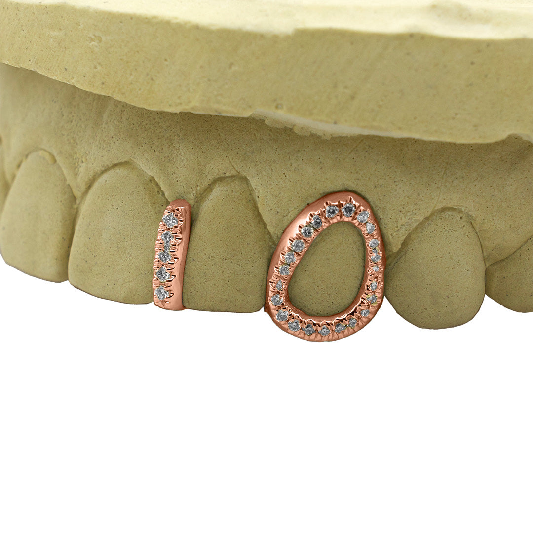 rose_gold_grillz_rose_cut_grillz_rose_gold_diamond_grillz_rose_gold_grillz_diamonds_rose_gold_mouth_grillz_rose_gold_grillz_in_mouth_rose_gold_grillz_diamond_cut_rose_gold_grillz_with_diamond_cuts_rose_gold_diamond_cut_grillz_rose_gold_grillz_bottom_rose_gold_bottom_grillz_silver_open_face_grillz_open_face_diamond_cut_grillz_open_face_white_gold_grillz_diamond_cut_open_face_grillz_white_gold_open_face_grillz_open_grillz_teeth_open_face_grillz_teeth_open_face_grillz_two_teeth