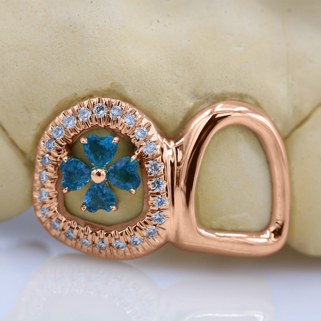 clover_gemstone_grillz_grillz_gold_grillz_grillz_near_me_diamond_grillz_custom_grillz_gold_grillz_near_me_custom_gold_grillz_gold_teeth_grillz_grillz_teeth_near_me_gold_grillz_jewelry_grillz_in_teeth_custom_grillz_near_me_teeth_grillz_grillz_for_teeth_teeth_grillz_near_me_open_face_grillz_grillz_for_teeth_near_me_gold_grillz_teeth_one_tooth_grillz_real_gold_grillz_diamond_grillz_on_teeth_diamond_grillz_teeth_grillz_with_diamond
