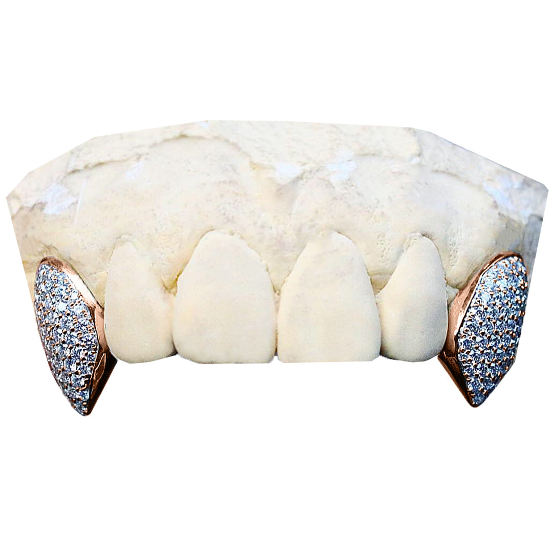 fang_grillz_grillz_on_fangs_rose_gold_grillz_fangs_grillz_fangs_vampire_fang_grillz_fang_vampire_grillz_diamond_fang_grillz_grillz_with_fangs_female_fang_grillz_fang_grillz_with_diamonds_diamond_grillz_with_fangs_fang_grillz_top_grillz_fangs_top_female_grillz_fangs_fang_grillz_teeth_top_fang_grillz_fang_bottom_grillz_diamond_grillz_fangs_white_gold_grillz_fangs_custom_fang_grillz_fangs_grillz_teeth_fang_diamond_grillz