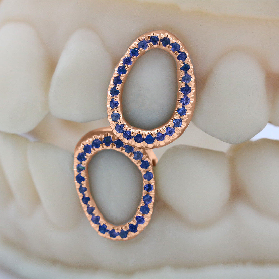 gemstone_grillz_grillz_rose_gold_grillz_grillz_near_me_diamond_grillz_custom_grillz_gold_grillz_near_me_custom_gold_grillz_gold_teeth_grillz_grillz_teeth_near_me_gold_grillz_jewelry_grillz_in_teeth_custom_grillz_near_me_teeth_grillz_grillz_for_teeth_teeth_grillz_near_me_open_face_grillz_grillz_for_teeth_near_me_gold_grillz_teeth_one_tooth_grillz_real_gold_grillz_diamond_grillz_on_teeth_diamond_grillz_teeth_grillz_with_diamond