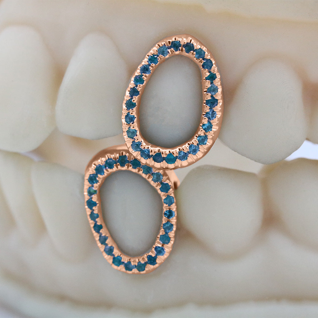 gemstone_grillz_grillz_rose_gold_grillz_grillz_near_me_diamond_grillz_custom_grillz_gold_grillz_near_me_custom_gold_grillz_gold_teeth_grillz_grillz_teeth_near_me_gold_grillz_jewelry_grillz_in_teeth_custom_grillz_near_me_teeth_grillz_grillz_for_teeth_teeth_grillz_near_me_open_face_grillz_grillz_for_teeth_near_me_gold_grillz_teeth_one_tooth_grillz_real_gold_grillz_diamond_grillz_on_teeth_diamond_grillz_teeth_grillz_with_diamond