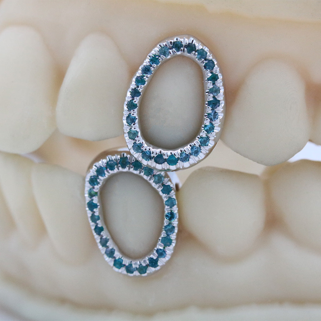 gemstone_grillz_grillz_white_gold_grillz_grillz_near_me_diamond_grillz_custom_grillz_gold_grillz_near_me_custom_gold_grillz_gold_teeth_grillz_grillz_teeth_near_me_gold_grillz_jewelry_grillz_in_teeth_custom_grillz_near_me_teeth_grillz_grillz_for_teeth_teeth_grillz_near_me_open_face_grillz_grillz_for_teeth_near_me_gold_grillz_teeth_one_tooth_grillz_real_gold_grillz_diamond_grillz_on_teeth_diamond_grillz_teeth_grillz_with_diamond