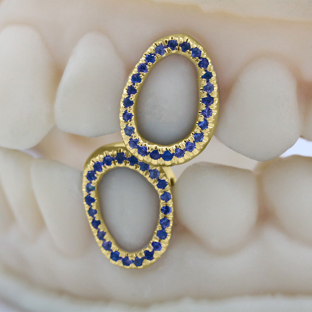gemstone_grillz_grillz_gold_grillz_grillz_near_me_diamond_grillz_custom_grillz_gold_grillz_near_me_custom_gold_grillz_gold_teeth_grillz_grillz_teeth_near_me_gold_grillz_jewelry_grillz_in_teeth_custom_grillz_near_me_teeth_grillz_grillz_for_teeth_teeth_grillz_near_me_open_face_grillz_grillz_for_teeth_near_me_gold_grillz_teeth_one_tooth_grillz_real_gold_grillz_diamond_grillz_on_teeth_diamond_grillz_teeth_grillz_with_diamond