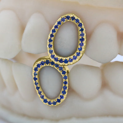 gemstone_grillz_grillz_gold_grillz_grillz_near_me_diamond_grillz_custom_grillz_gold_grillz_near_me_custom_gold_grillz_gold_teeth_grillz_grillz_teeth_near_me_gold_grillz_jewelry_grillz_in_teeth_custom_grillz_near_me_teeth_grillz_grillz_for_teeth_teeth_grillz_near_me_open_face_grillz_grillz_for_teeth_near_me_gold_grillz_teeth_one_tooth_grillz_real_gold_grillz_diamond_grillz_on_teeth_diamond_grillz_teeth_grillz_with_diamond