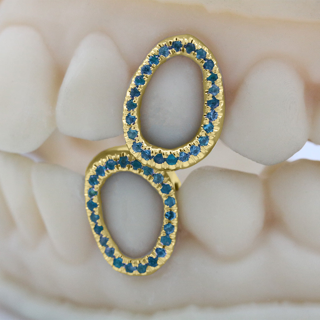 gemstone_grillz_grillz_gold_grillz_grillz_near_me_diamond_grillz_custom_grillz_gold_grillz_near_me_custom_gold_grillz_gold_teeth_grillz_grillz_teeth_near_me_gold_grillz_jewelry_grillz_in_teeth_custom_grillz_near_me_teeth_grillz_grillz_for_teeth_teeth_grillz_near_me_open_face_grillz_grillz_for_teeth_near_me_gold_grillz_teeth_one_tooth_grillz_real_gold_grillz_diamond_grillz_on_teeth_diamond_grillz_teeth_grillz_with_diamond