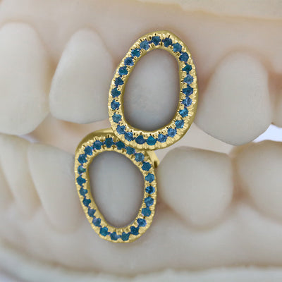 gemstone_grillz_grillz_gold_grillz_grillz_near_me_diamond_grillz_custom_grillz_gold_grillz_near_me_custom_gold_grillz_gold_teeth_grillz_grillz_teeth_near_me_gold_grillz_jewelry_grillz_in_teeth_custom_grillz_near_me_teeth_grillz_grillz_for_teeth_teeth_grillz_near_me_open_face_grillz_grillz_for_teeth_near_me_gold_grillz_teeth_one_tooth_grillz_real_gold_grillz_diamond_grillz_on_teeth_diamond_grillz_teeth_grillz_with_diamond