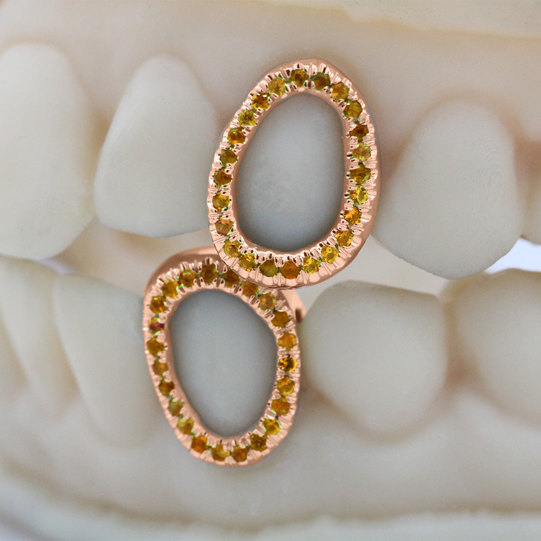 gemstone_grillz_grillz_rose_gold_grillz_grillz_near_me_diamond_grillz_custom_grillz_gold_grillz_near_me_custom_gold_grillz_gold_teeth_grillz_grillz_teeth_near_me_gold_grillz_jewelry_grillz_in_teeth_custom_grillz_near_me_teeth_grillz_grillz_for_teeth_teeth_grillz_near_me_open_face_grillz_grillz_for_teeth_near_me_gold_grillz_teeth_one_tooth_grillz_real_gold_grillz_diamond_grillz_on_teeth_diamond_grillz_teeth_grillz_with_diamond