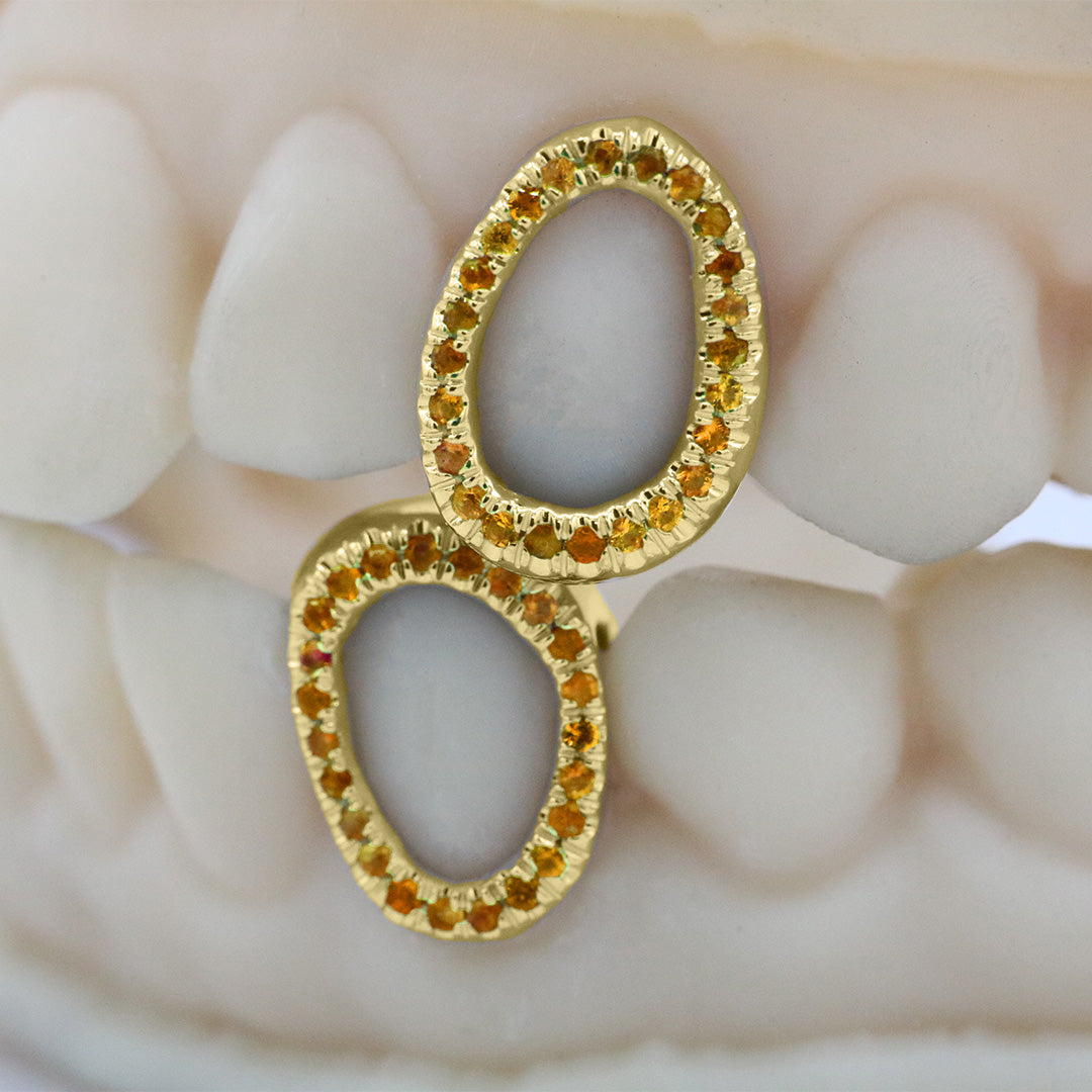 gemstone_grillz_grillz_gold_grillz_grillz_near_me_diamond_grillz_custom_grillz_gold_grillz_near_me_custom_gold_grillz_gold_teeth_grillz_grillz_teeth_near_me_gold_grillz_jewelry_grillz_in_teeth_custom_grillz_near_me_teeth_grillz_grillz_for_teeth_teeth_grillz_near_me_open_face_grillz_grillz_for_teeth_near_me_gold_grillz_teeth_one_tooth_grillz_real_gold_grillz_diamond_grillz_on_teeth_diamond_grillz_teeth_grillz_with_diamond