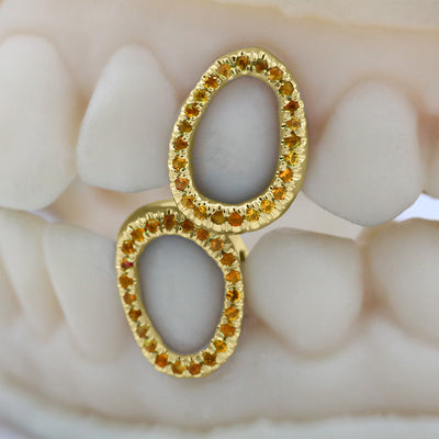 gemstone_grillz_grillz_gold_grillz_grillz_near_me_diamond_grillz_custom_grillz_gold_grillz_near_me_custom_gold_grillz_gold_teeth_grillz_grillz_teeth_near_me_gold_grillz_jewelry_grillz_in_teeth_custom_grillz_near_me_teeth_grillz_grillz_for_teeth_teeth_grillz_near_me_open_face_grillz_grillz_for_teeth_near_me_gold_grillz_teeth_one_tooth_grillz_real_gold_grillz_diamond_grillz_on_teeth_diamond_grillz_teeth_grillz_with_diamond