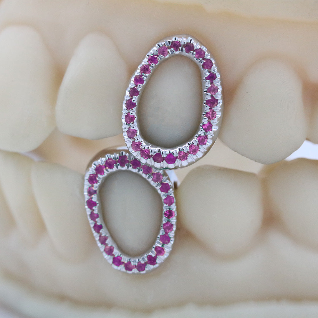 gemstone_grillz_grillz_white_gold_grillz_grillz_near_me_diamond_grillz_custom_grillz_gold_grillz_near_me_custom_gold_grillz_gold_teeth_grillz_grillz_teeth_near_me_gold_grillz_jewelry_grillz_in_teeth_custom_grillz_near_me_teeth_grillz_grillz_for_teeth_teeth_grillz_near_me_open_face_grillz_grillz_for_teeth_near_me_gold_grillz_teeth_one_tooth_grillz_real_gold_grillz_diamond_grillz_on_teeth_diamond_grillz_teeth_grillz_with_diamond