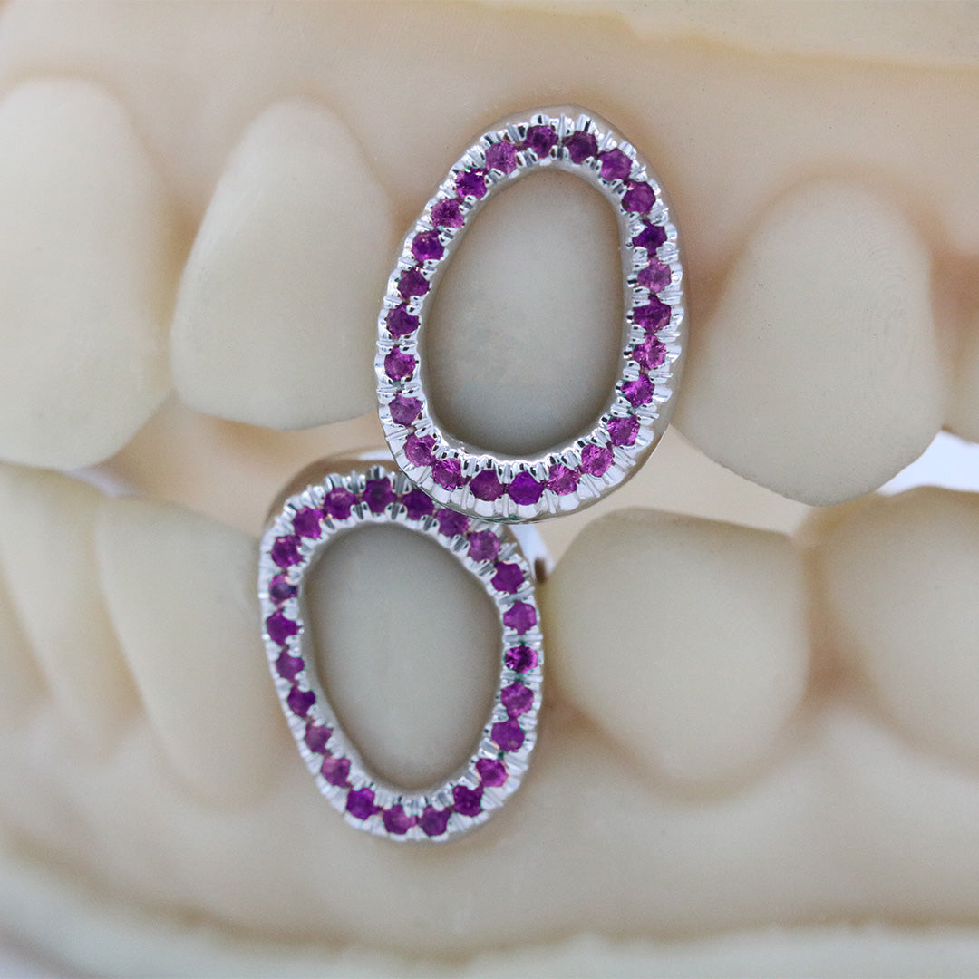 gemstone_grillz_grillz_white_gold_grillz_grillz_near_me_diamond_grillz_custom_grillz_gold_grillz_near_me_custom_gold_grillz_gold_teeth_grillz_grillz_teeth_near_me_gold_grillz_jewelry_grillz_in_teeth_custom_grillz_near_me_teeth_grillz_grillz_for_teeth_teeth_grillz_near_me_open_face_grillz_grillz_for_teeth_near_me_gold_grillz_teeth_one_tooth_grillz_real_gold_grillz_diamond_grillz_on_teeth_diamond_grillz_teeth_grillz_with_diamond