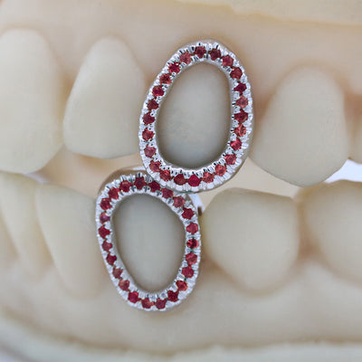 gemstone_grillz_grillz_white_gold_grillz_grillz_near_me_diamond_grillz_custom_grillz_gold_grillz_near_me_custom_gold_grillz_gold_teeth_grillz_grillz_teeth_near_me_gold_grillz_jewelry_grillz_in_teeth_custom_grillz_near_me_teeth_grillz_grillz_for_teeth_teeth_grillz_near_me_open_face_grillz_grillz_for_teeth_near_me_gold_grillz_teeth_one_tooth_grillz_real_gold_grillz_diamond_grillz_on_teeth_diamond_grillz_teeth_grillz_with_diamond