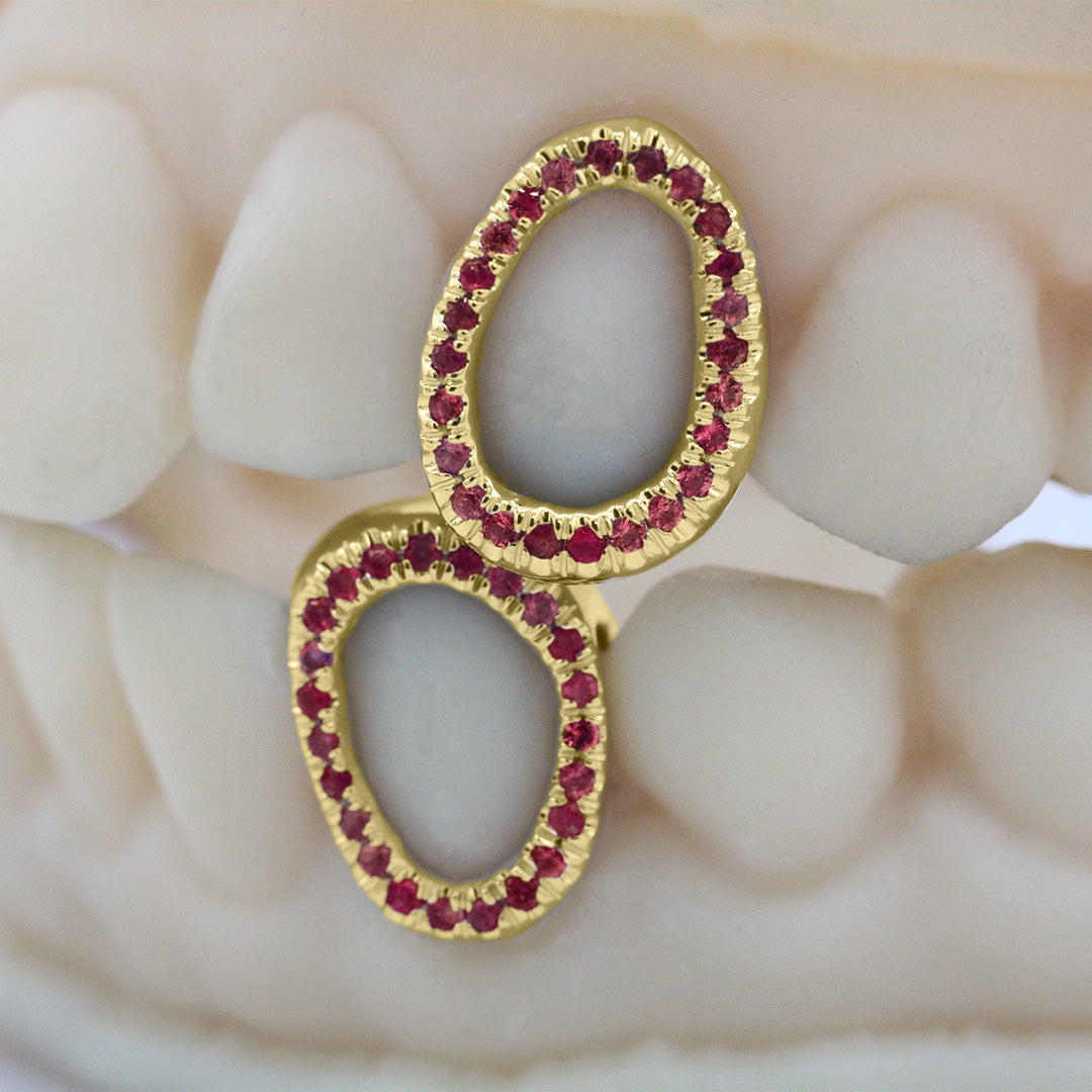 gemstone_grillz_grillz_gold_grillz_grillz_near_me_diamond_grillz_custom_grillz_gold_grillz_near_me_custom_gold_grillz_gold_teeth_grillz_grillz_teeth_near_me_gold_grillz_jewelry_grillz_in_teeth_custom_grillz_near_me_teeth_grillz_grillz_for_teeth_teeth_grillz_near_me_open_face_grillz_grillz_for_teeth_near_me_gold_grillz_teeth_one_tooth_grillz_real_gold_grillz_diamond_grillz_on_teeth_diamond_grillz_teeth_grillz_with_diamond