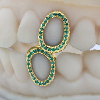 Gemstone Grillz