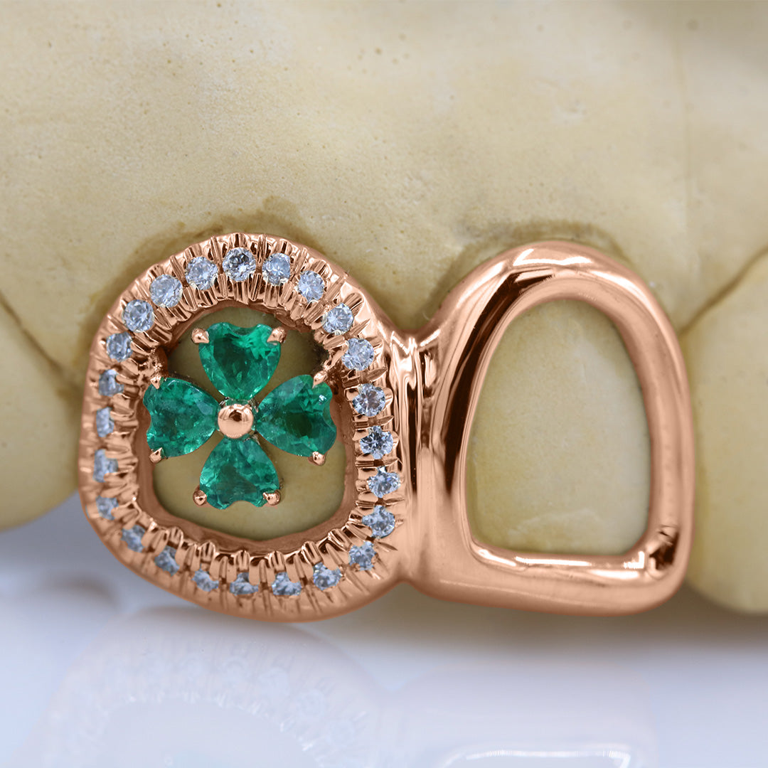 clover_gemstone_grillz_grillz_gold_grillz_grillz_near_me_diamond_grillz_custom_grillz_gold_grillz_near_me_custom_gold_grillz_gold_teeth_grillz_grillz_teeth_near_me_gold_grillz_jewelry_grillz_in_teeth_custom_grillz_near_me_teeth_grillz_grillz_for_teeth_teeth_grillz_near_me_open_face_grillz_grillz_for_teeth_near_me_gold_grillz_teeth_one_tooth_grillz_real_gold_grillz_diamond_grillz_on_teeth_diamond_grillz_teeth_grillz_with_diamond

