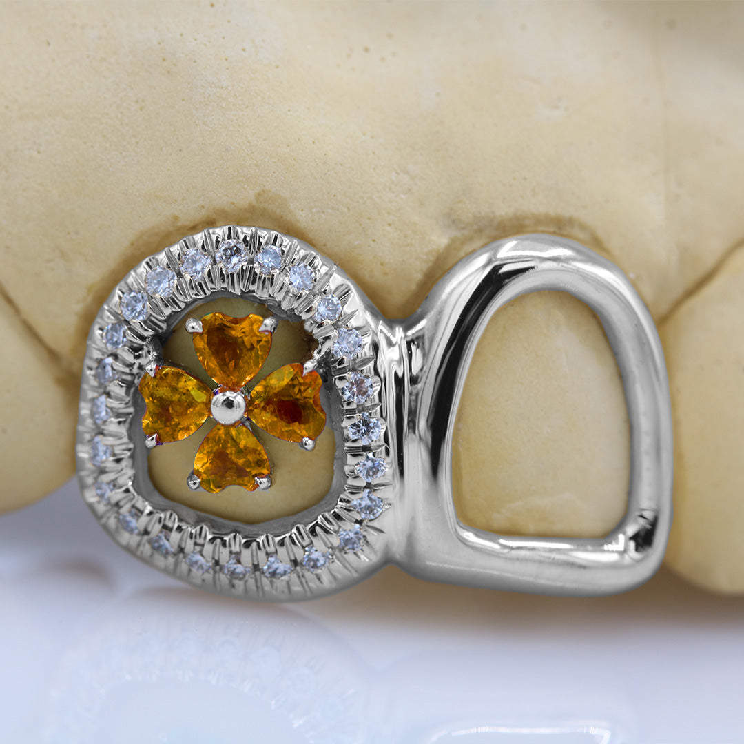 clover_gemstone_grillz_grillz_gold_grillz_grillz_near_me_diamond_grillz_custom_grillz_gold_grillz_near_me_custom_gold_grillz_gold_teeth_grillz_grillz_teeth_near_me_gold_grillz_jewelry_grillz_in_teeth_custom_grillz_near_me_teeth_grillz_grillz_for_teeth_teeth_grillz_near_me_open_face_grillz_grillz_for_teeth_near_me_gold_grillz_teeth_one_tooth_grillz_real_gold_grillz_diamond_grillz_on_teeth_diamond_grillz_teeth_grillz_with_diamond
