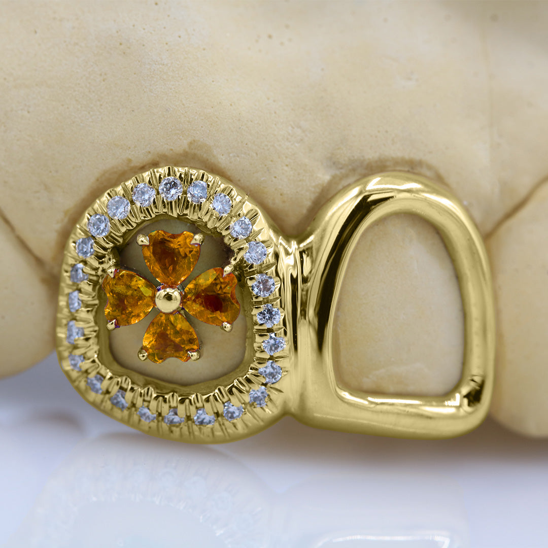 clover_gemstone_grillz_grillz_gold_grillz_grillz_near_me_diamond_grillz_custom_grillz_gold_grillz_near_me_custom_gold_grillz_gold_teeth_grillz_grillz_teeth_near_me_gold_grillz_jewelry_grillz_in_teeth_custom_grillz_near_me_teeth_grillz_grillz_for_teeth_teeth_grillz_near_me_open_face_grillz_grillz_for_teeth_near_me_gold_grillz_teeth_one_tooth_grillz_real_gold_grillz_diamond_grillz_on_teeth_diamond_grillz_teeth_grillz_with_diamond
