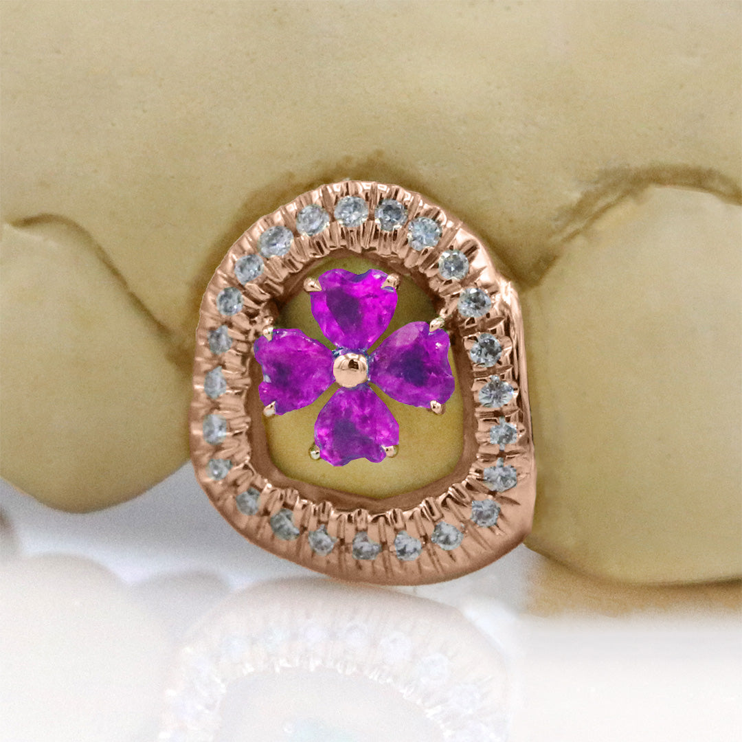 clover_gemstone_grillz_grillz_gold_grillz_grillz_near_me_diamond_grillz_custom_grillz_gold_grillz_near_me_custom_gold_grillz_gold_teeth_grillz_grillz_teeth_near_me_gold_grillz_jewelry_grillz_in_teeth_custom_grillz_near_me_teeth_grillz_grillz_for_teeth_teeth_grillz_near_me_open_face_grillz_grillz_for_teeth_near_me_gold_grillz_teeth_one_tooth_grillz_real_gold_grillz_diamond_grillz_on_teeth_diamond_grillz_teeth_grillz_with_diamond