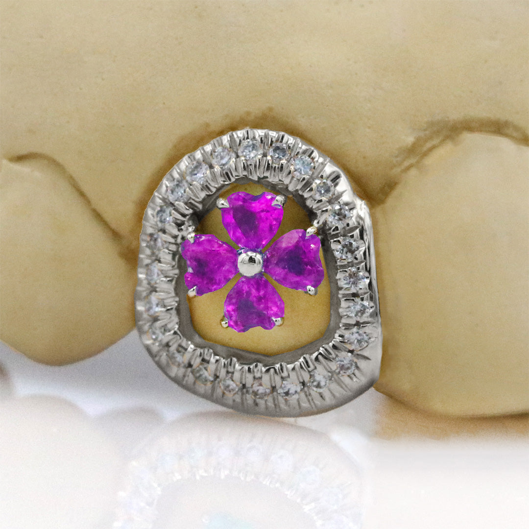 clover_gemstone_grillz_grillz_gold_grillz_grillz_near_me_diamond_grillz_custom_grillz_gold_grillz_near_me_custom_gold_grillz_gold_teeth_grillz_grillz_teeth_near_me_gold_grillz_jewelry_grillz_in_teeth_custom_grillz_near_me_teeth_grillz_grillz_for_teeth_teeth_grillz_near_me_open_face_grillz_grillz_for_teeth_near_me_gold_grillz_teeth_one_tooth_grillz_real_gold_grillz_diamond_grillz_on_teeth_diamond_grillz_teeth_grillz_with_diamond